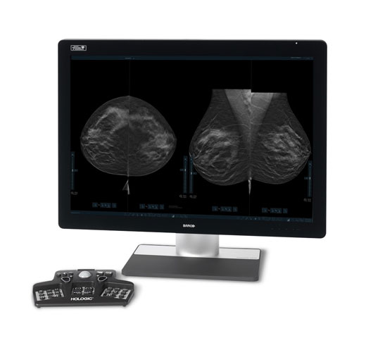 Hologic 3DQuorum™ Imaging Technology mot vit bakgrund