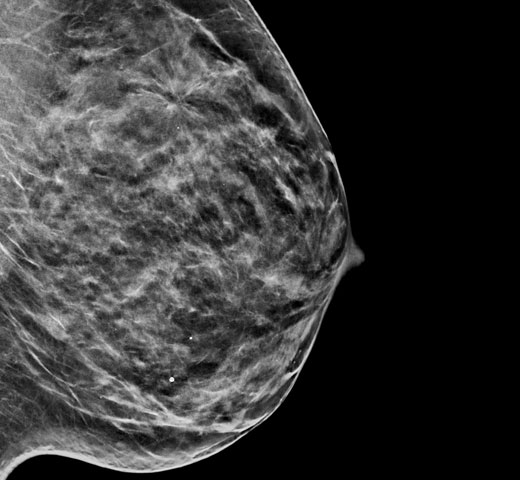 Hologic C-View™ Synthesised 2D Imaging mot vit bakgrund