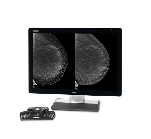 Hologic Intelligent 2D™ Synthesised Imaging mot vit bakgrund