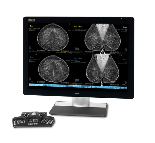 Hologic SecurView® Breast Imaging Workstation mot vit bakgrund
