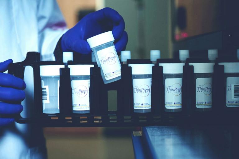 Flera Thinprep-provburkar på ställ