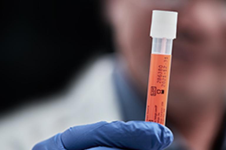 Handskbeklädd hand som håller en provburk