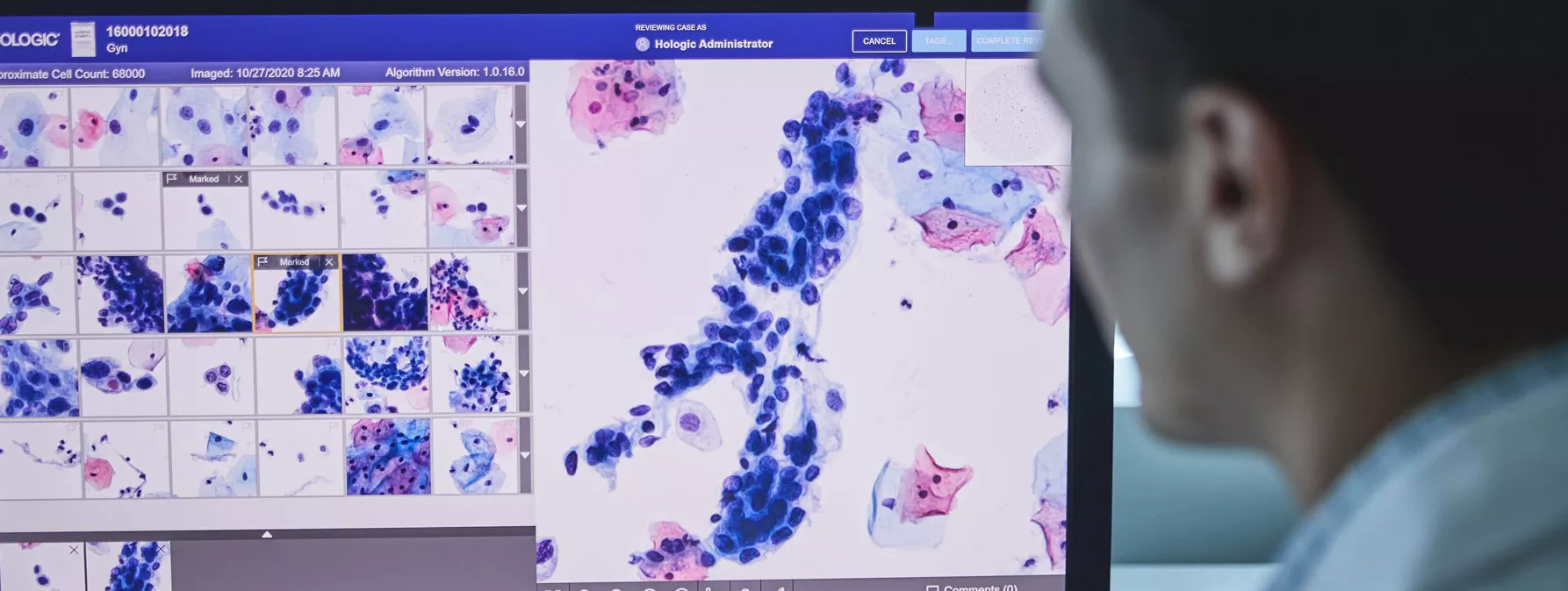 Bild av Genius™ Digital Diagnostics System