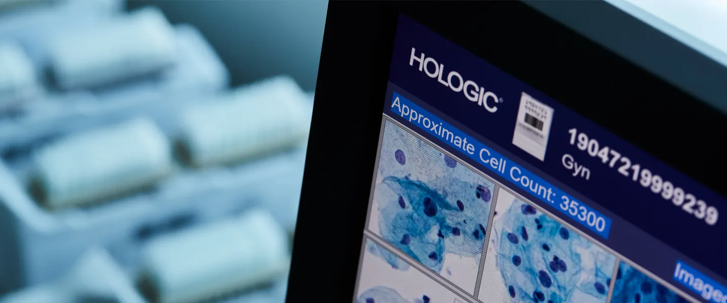 Cytologiprover på objektsglas och hörnet av en skärm som visar digitala cytologisvar, redo för analys.