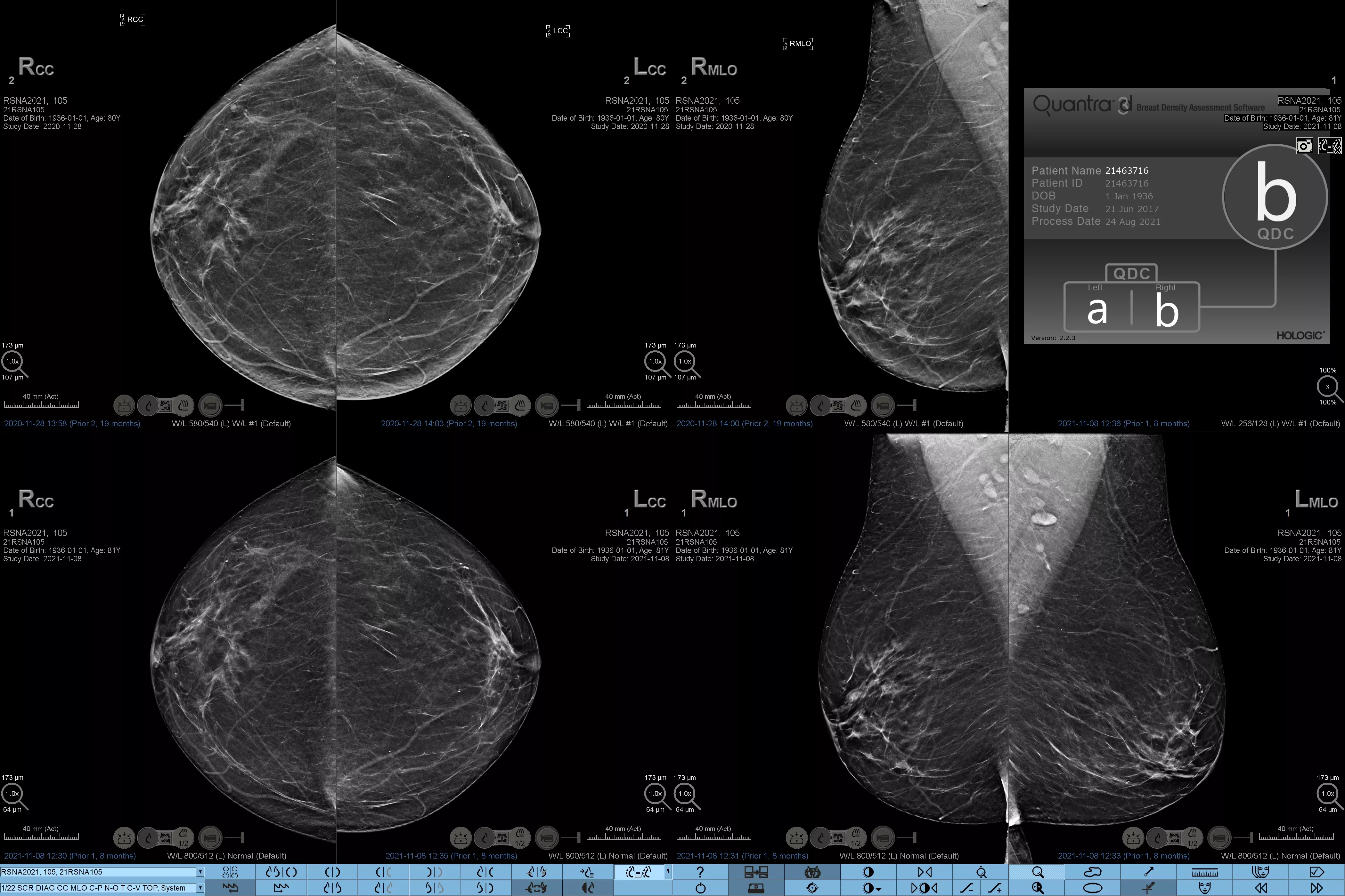 Transducer-L18-5 mot vit bakgrund