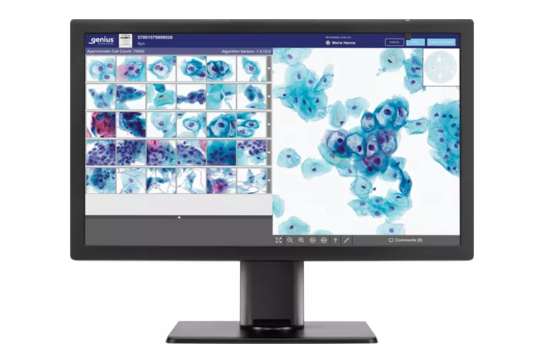 Bild av Genius-skärm