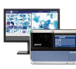 Hologic Genius™ Digital Diagnostics System mot vit bakgrund