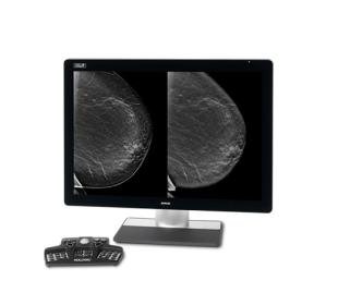 Hologic Intelligent 2D™ Synthesised Imaging mot vit bakgrund