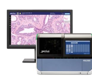 Genius Digital Diagnostics Imager och bildskärm som visar cervikala celler