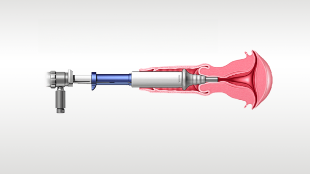 Illustrationen visar en medicinteknisk enhet som används.